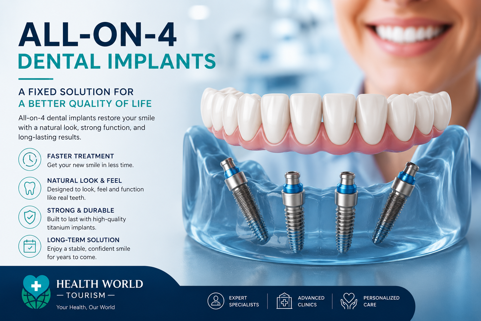All-on-4 Dental İmplant Tedavisi: Yeni Bir Gülüşe Güvenle Başlayın